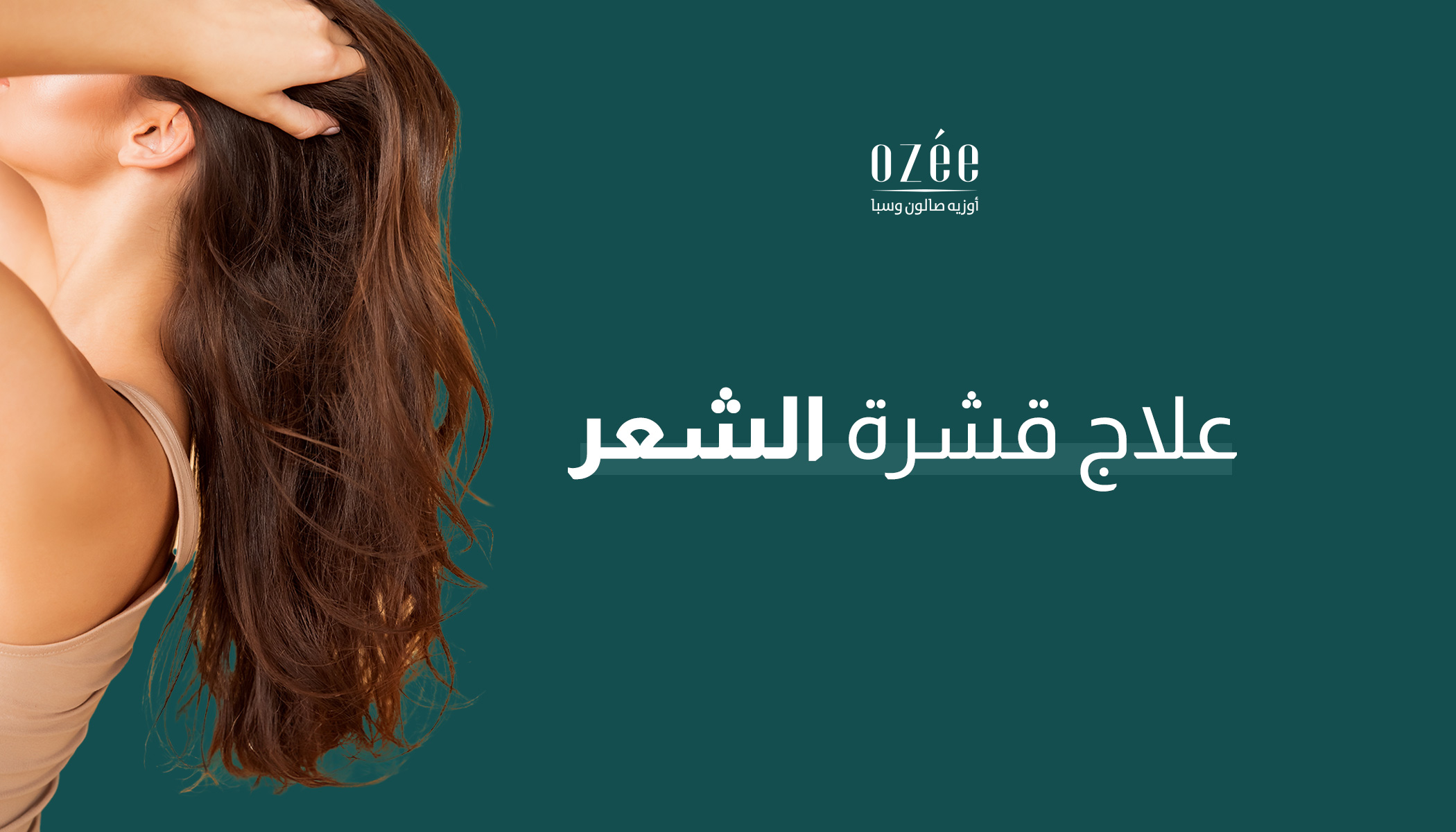 Dandruff Treatment: Everything You Need to Know